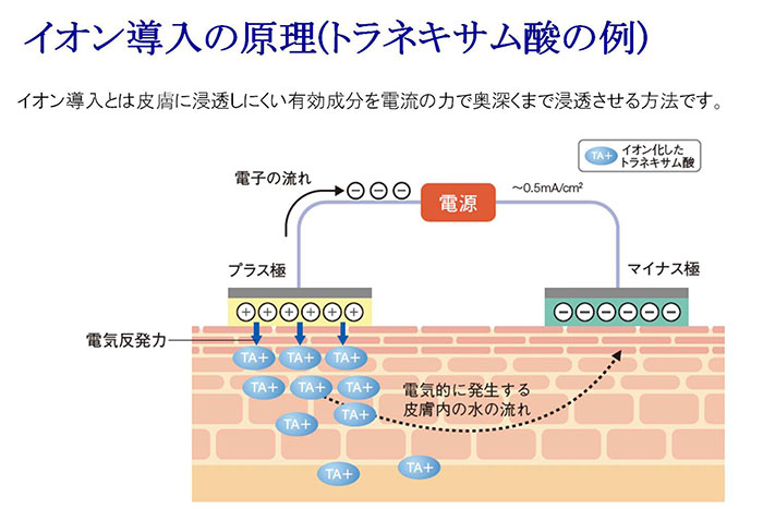 イオン導入（資生堂ナビジョン）｜けやき美容クリニック｜沼津 静岡