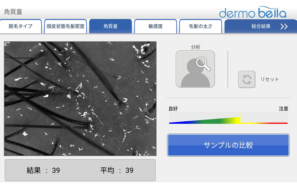 カウンセリングマイクロスコープ頭皮用 3R-WMBTPRIME-H | スリーアール
