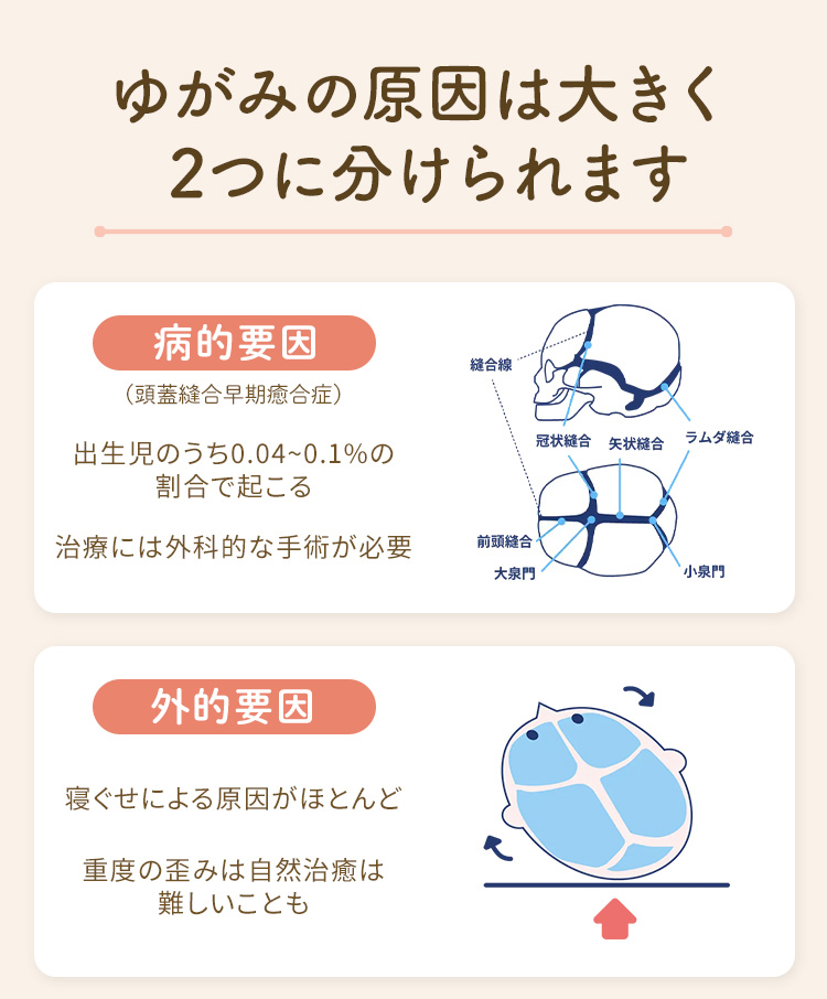 赤ちゃんの頭の形に寄り添う医療