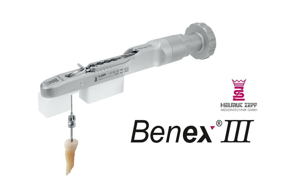 インプラント/外科｜インプラント