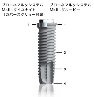 東京で審美インプラントならウケデンタルオフィス｜池袋・神谷町・大
