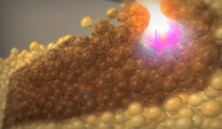 ライポソニックス - 美容外科・美容皮膚科｜五本木クリニック