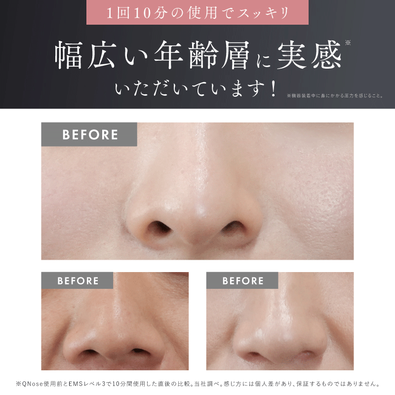 NIPLUX公式店】QNose│キュノーズ│鼻専用美顔器│鼻から始まる美印象