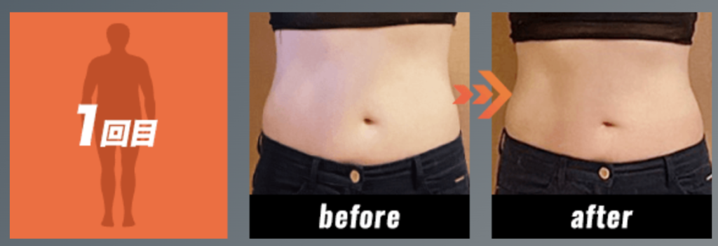 電磁パルス痩身機ボディカルプトの特徴や効果、価格についてご紹介