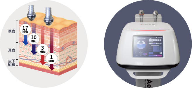 高密度超音波 T-SONIC - エステ美容商材 卸販売 仕入れ ann-J(アンジェ)