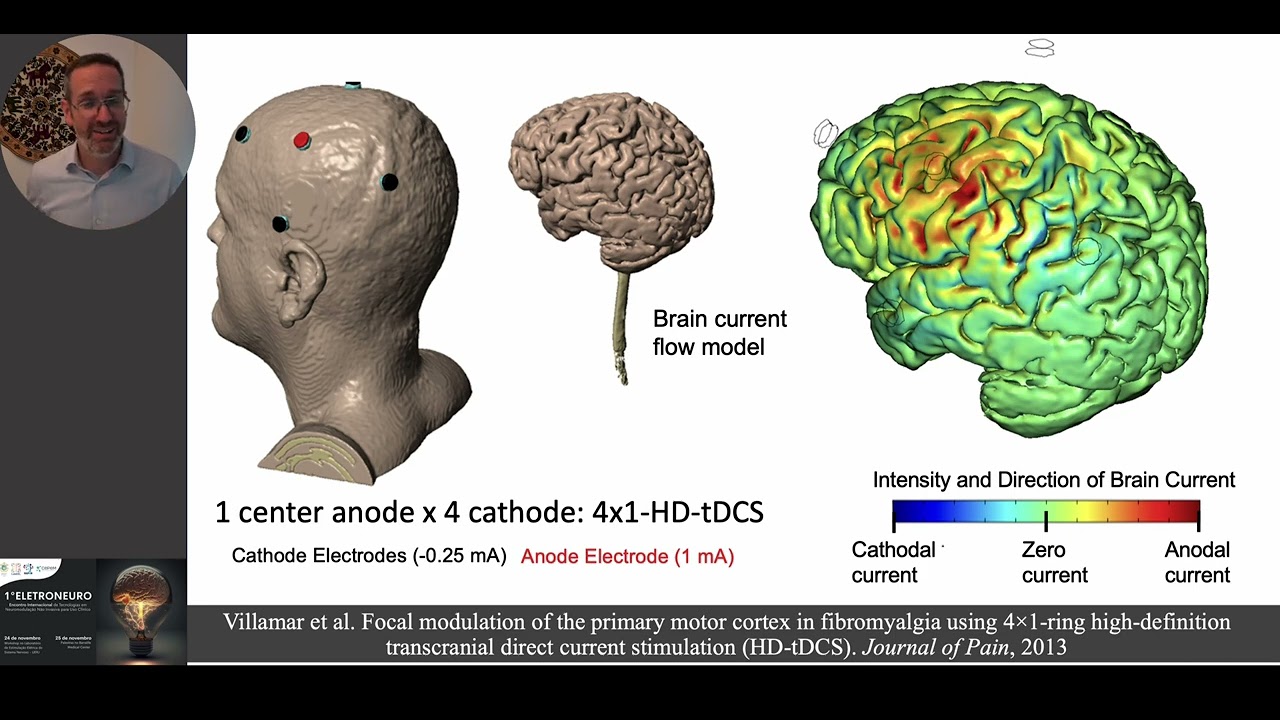 Optimizing brain targeting with HD-tDCS (how to design tDCS