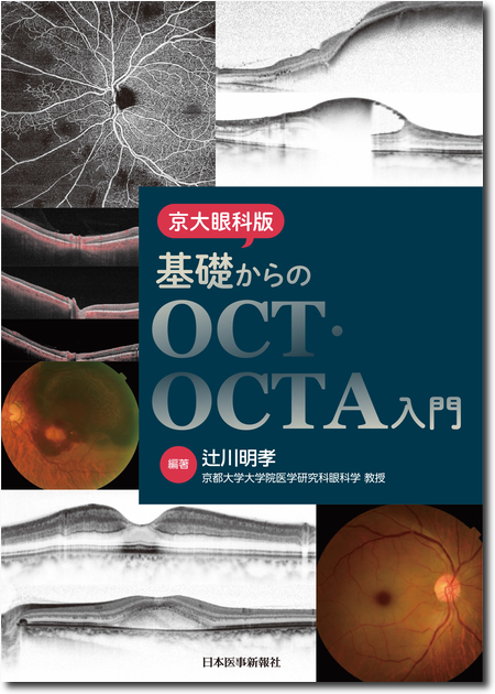 m3電子書籍 | 新OCT・OCTA読影トレーニング 改訂第2版