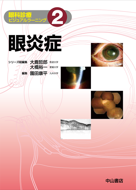 m3電子書籍 | 角膜，結膜〈眼科診療ビジュアルラーニング1〉