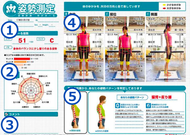 姿勢・歩行分析 | いとひや整骨院｜千葉市おゆみ野・鎌取
