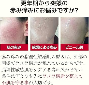 Amazon | 突然の赤み痒みに クレチュール [ 化粧水/クリーム 2点セット