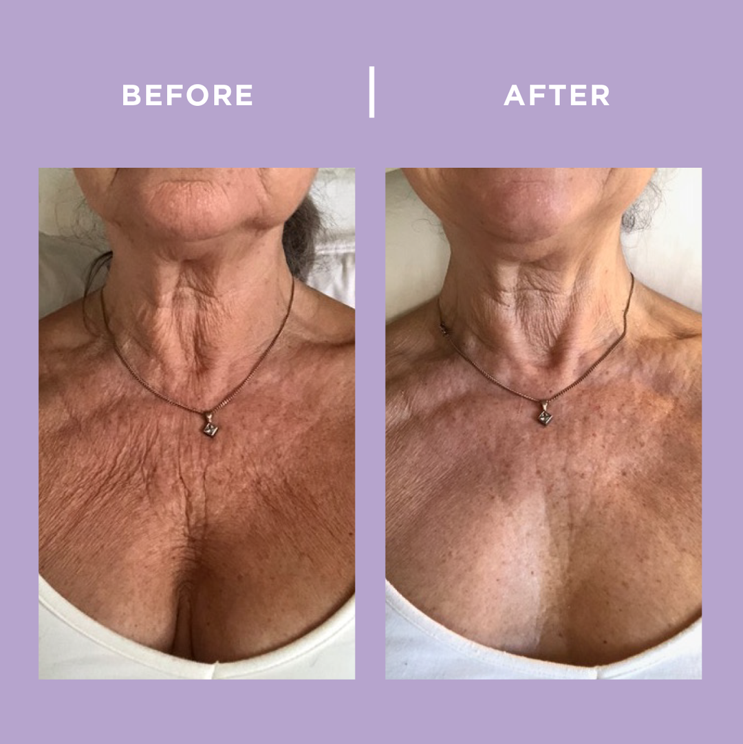 PRAI PRO Face Correct Wrinkle Serum – PRAI Beauty